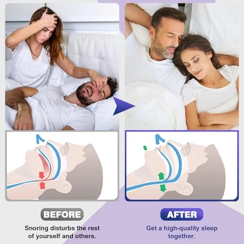 Snore Stopper Set - Adjustable Magnetic Nose Clip for Quiet & Comfortable Sleep